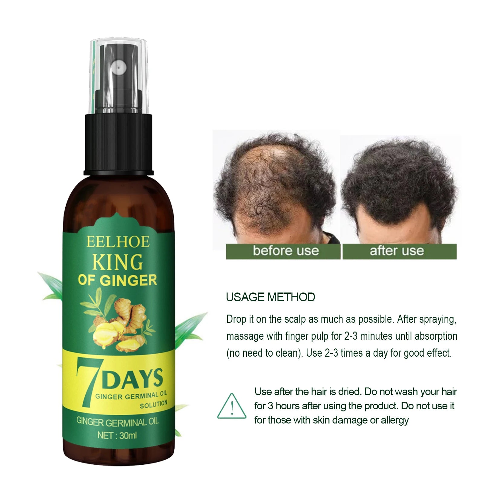 Ginger Care Hair Spray Hair Growth Essence Nourish Hair Roots Massage Scalp Repair