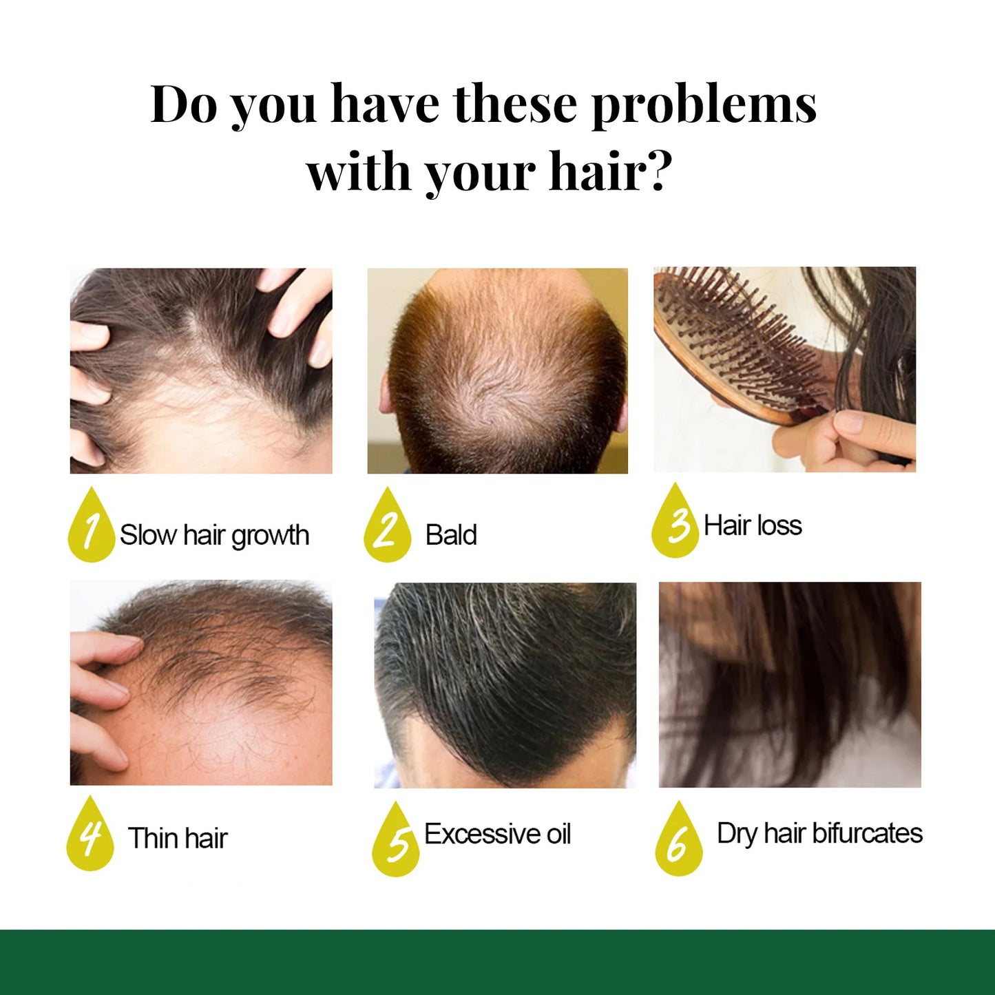 Ginger Care Hair Spray Hair Growth Essence Nourish Hair Roots Massage Scalp Repair