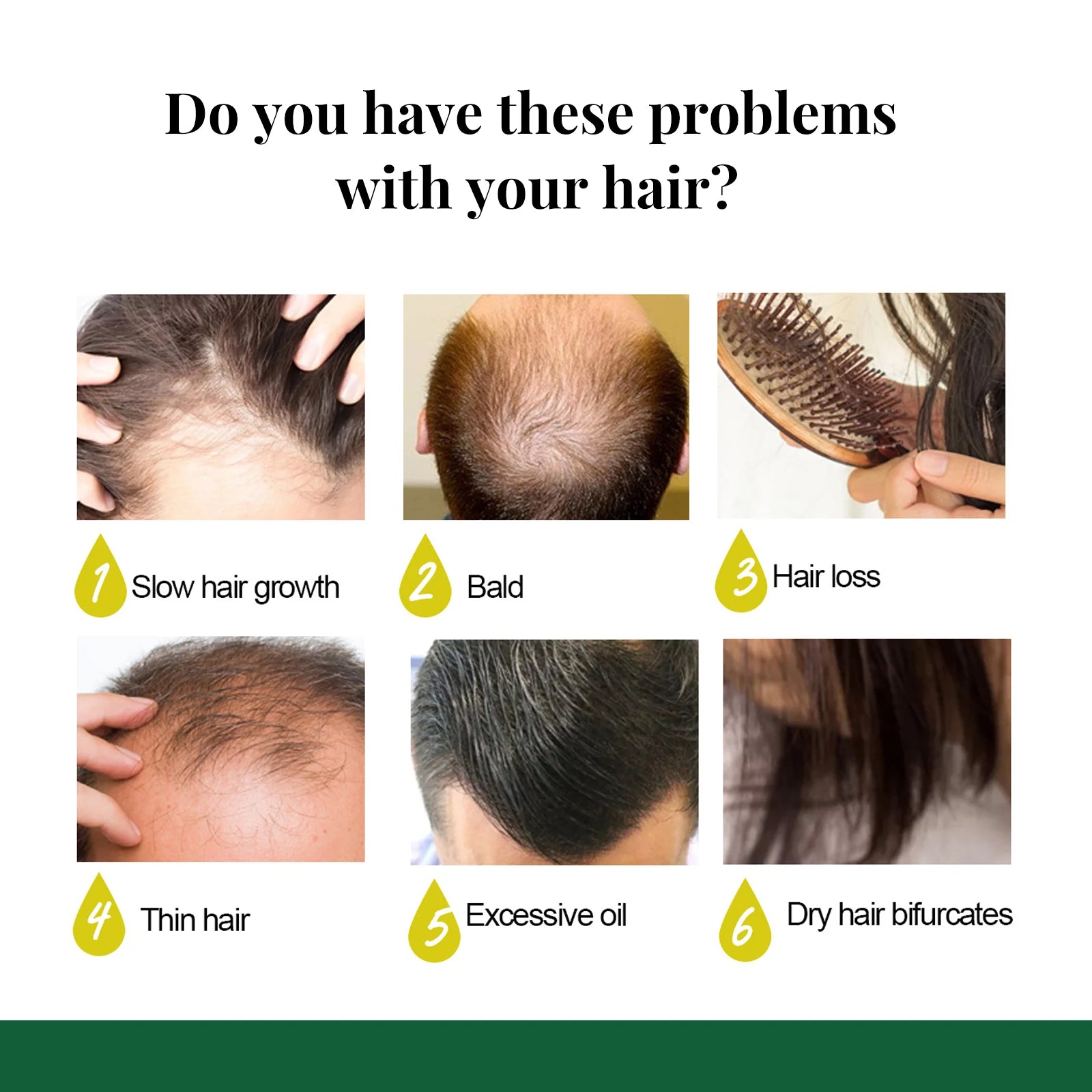 Ginger Care Hair Spray Hair Growth Essence Nourish Hair Roots Massage Scalp Repair