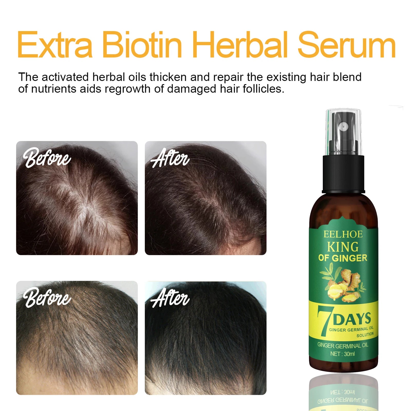 Ginger Care Hair Spray Hair Growth Essence Nourish Hair Roots Massage Scalp Repair
